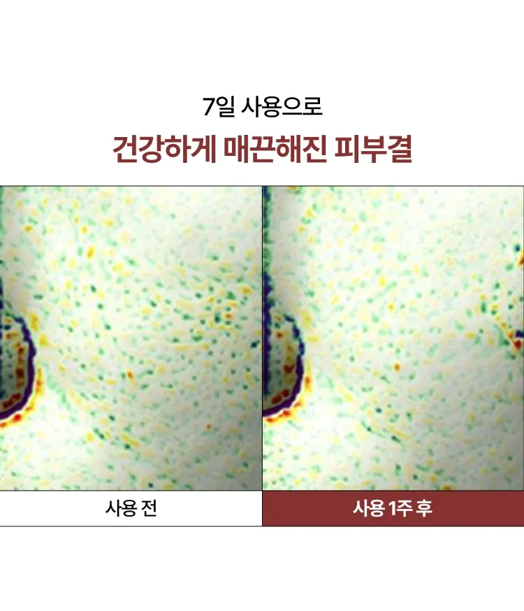 산뜻하고 빠르게 흡수되는 물 제형 워터리 포뮬러 에센스. 지친 피부 컨디션과 쌓인 각질로 인해 칙칙하고 거칠어진 피부결을 개선. 닦토, 흡토, 팩토 모두 가능한 매일 부담 없이 피부 항산화케어로 투명하게 빛나는 투명광채피부를 만들어주는 이니스프리 블랙티 유스 인핸싱 트리트먼트 에센스.