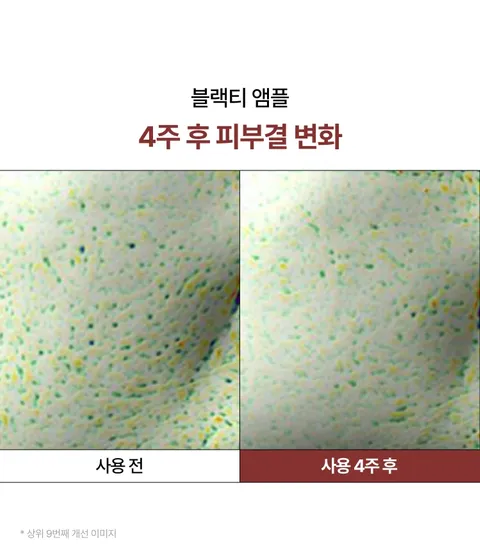 복합적인 피부고민과 지친 피부 컨디션을 빠르게 케어해주는 집중 안티에이징 항산화 앰플. 리셋 컨센트레이트, 히알루론산, 스쿠알란 함유되어 보습과 수분 동시에 충전. 피부톤, 광채, 윤기, 피부결, 탄력 개선되어 쫀쫀한 피부 완성. 피부과 테스트 하이포알러제닉테스트 완료하여 민감성 피부도 사용가능한 이니스프리 블랙티 유스 인핸싱 앰플 대용량 스페셜 기획 세트
