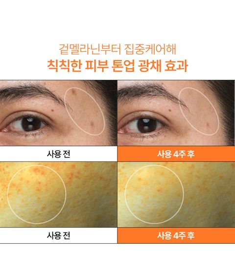 비타민C와 제주 녹차 엔자임을 함유한 세럼이 피부톤과 피부결을 케어해 매끈 투명한 피부로 가꿔주는 잡티 토닝 세럼