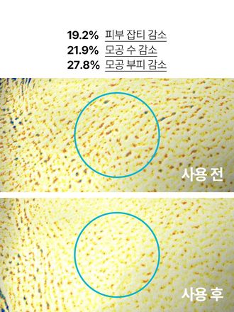 트러블의 시작부터, 각질, 모공, 잡티흔적 케어로 매끈한 피부결 관리 저자극 고효능 앰플