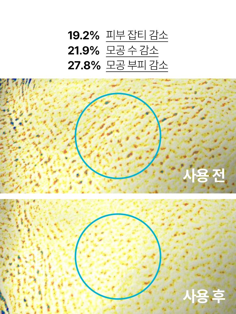 트러블의 시작부터, 각질, 모공, 잡티흔적 케어로 매끈한 피부결 관리 저자극 고효능 앰플