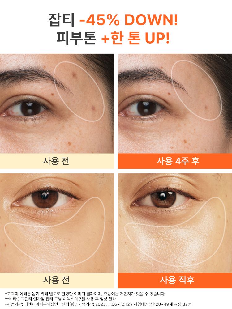 단 7일만에 피부톤과 잡티를 개선해 맑아지는 피부를 느낄 수 있는 이니스프리 비타민C 톤업 세럼. 잡티 케어와 항산화 효과 그리고 피부결 케어 및 광채 부스팅으로 아침 저녁 데일리로 쓰기 좋은 토탈 브라이트닝 추천 세럼. 비타민C와 제주 녹차 엔자임을 함유한 세럼이 피부톤과 피부결을 케어해 매끈 투명한 피부로 가꿔주는 잡티 토닝 세럼 그린홀리데이 에디션