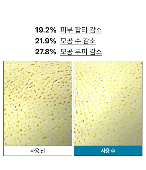 모공 흔적은 깨끗하게, 색소 흔적은 옅어지게! 모공&흔적을 개선하여 깨끗하고 매끄러워진 깐달걀 피부결로 가꿔주는 저자극 이니스프리 레티놀 시카 흔적 앰플 대용량 더블 구성