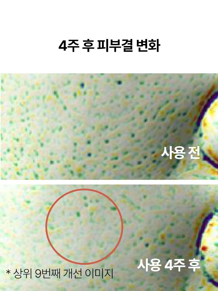 복합적인 피부고민과 지친 피부 컨디션을 빠르게 케어해주는 집중 안티에이징 항산화 앰플. 리셋 컨센트레이트, 히알루론산, 스쿠알란 함유되어 보습과 수분 동시에 충전. 피부톤, 광채, 윤기, 피부결, 탄력 개선되어 쫀쫀한 피부 완성. 피부과 테스트 하이포알러제닉테스트 완료하여 민감성 피부도 사용가능한 이니스프리 블랙티 유스 인핸싱 앰플
