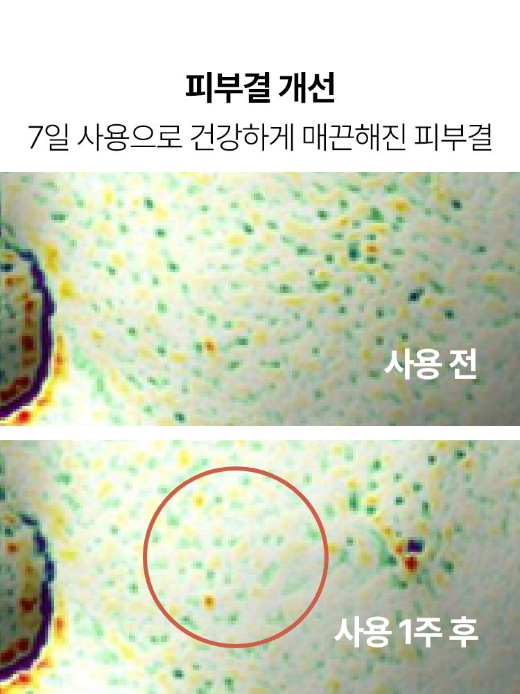 산뜻하고 빠르게 흡수되는 물 제형 워터리 포뮬러 에센스. 지친 피부 컨디션과 쌓인 각질로 인해 칙칙하고 거칠어진 피부결을 개선. 닦토, 흡토, 팩토 모두 가능한 매일 부담 없이 피부 항산화케어로 투명하게 빛나는 투명광채피부를 만들어주는 이니스프리 블랙티 유스 인핸싱 트리트먼트 에센스 소용량