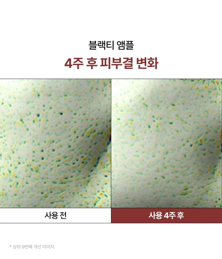 복합적인 피부고민과 지친 피부 컨디션을 빠르게 케어해주는 집중 안티에이징 항산화 앰플. 리셋 컨센트레이트, 히알루론산, 스쿠알란 함유되어 보습과 수분 동시에 충전. 피부톤, 광채, 윤기, 피부결, 탄력 개선되어 쫀쫀한 피부 완성. 피부과 테스트 하이포알러제닉테스트 완료하여 민감성 피부도 사용가능한 이니스프리 블랙티 유스 인핸싱 앰플 대용량