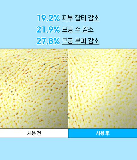 이니스프리 레티놀 시카 흔적 앰플은 레티놀과 시카 성분을 결합해 모공 흔적과 색소침착을 한 번에 케어하는 저자극 고효능 앰플입니다. 4주 사용 후 모공 부피 27.8% 감소 효과를 입증했으며, 비건 인증 및 7가지 피부 적합 테스트를 완료하여 민감성 피부도 안심하고 사용할 수 있습니다. 민감피부 자극 반응도에서 Score 0.0으로 저자극이 확인되었습니다.