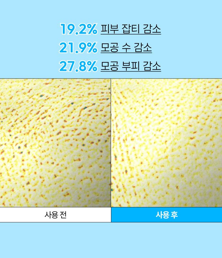 이니스프리 레티놀 시카 흔적 앰플은 레티놀과 시카 성분을 결합해 모공 흔적과 색소침착을 한 번에 케어하는 저자극 고효능 앰플입니다. 4주 사용 후 모공 부피 27.8% 감소 효과를 입증했으며, 비건 인증 및 7가지 피부 적합 테스트를 완료하여 민감성 피부도 안심하고 사용할 수 있습니다. 민감피부 자극 반응도에서 Score 0.0으로 저자극이 확인되었습니다.