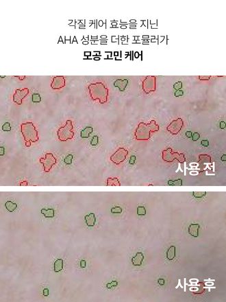 강력한 피지 흡착력을 지닌 화산송이, AHA가 함유된 포뮬러가 모공을 집중 케어해 주는 클레이 마스크