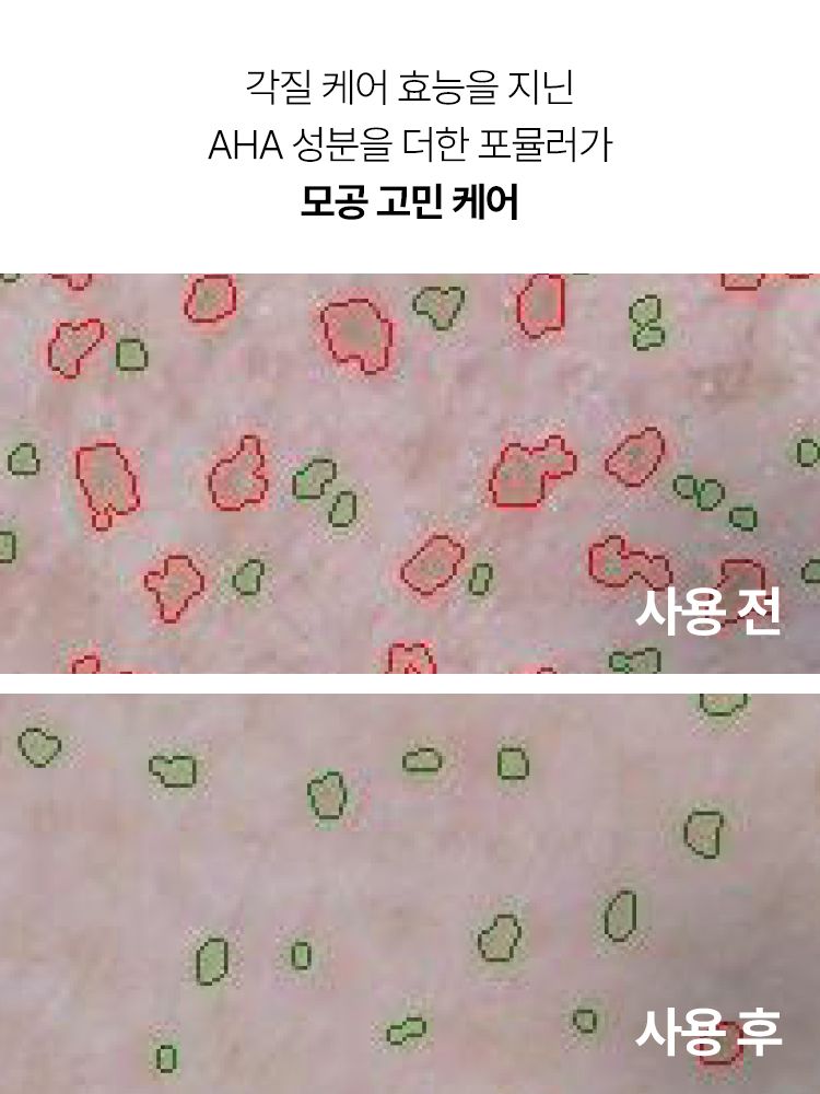강력한 피지 흡착력을 지닌 화산송이, AHA가 함유된 포뮬러가 모공을 집중 케어해 주는 클레이 마스크