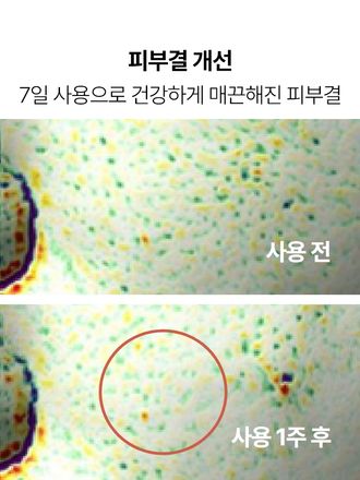 칙칙하고 거칠어진 피부를 빛나는 투명 피부로 가꾸어주는 항산화 트리트먼트 에센스