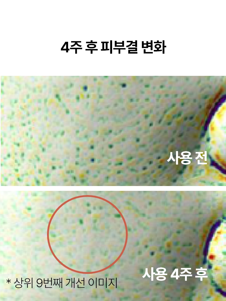 지친 피부의 컨디션을 빠르게 케어해주는 집중 안티에이징 앰플 