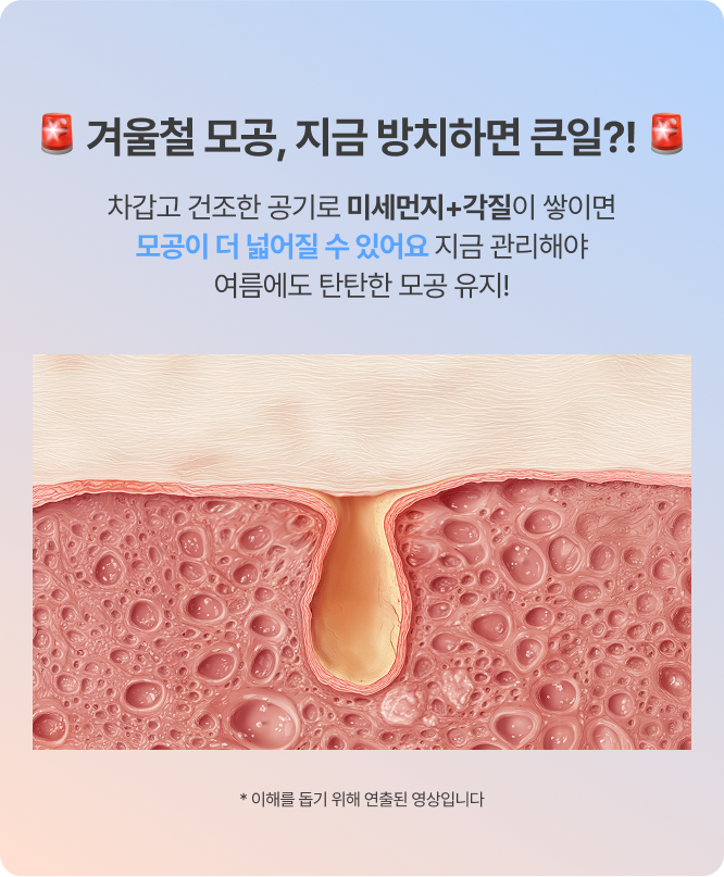 겨울철 모공, 지금 방치하면 큰일?!