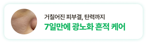 거칠어진 피부결, 탄력까지 7일만에 광노화 흔적 케어