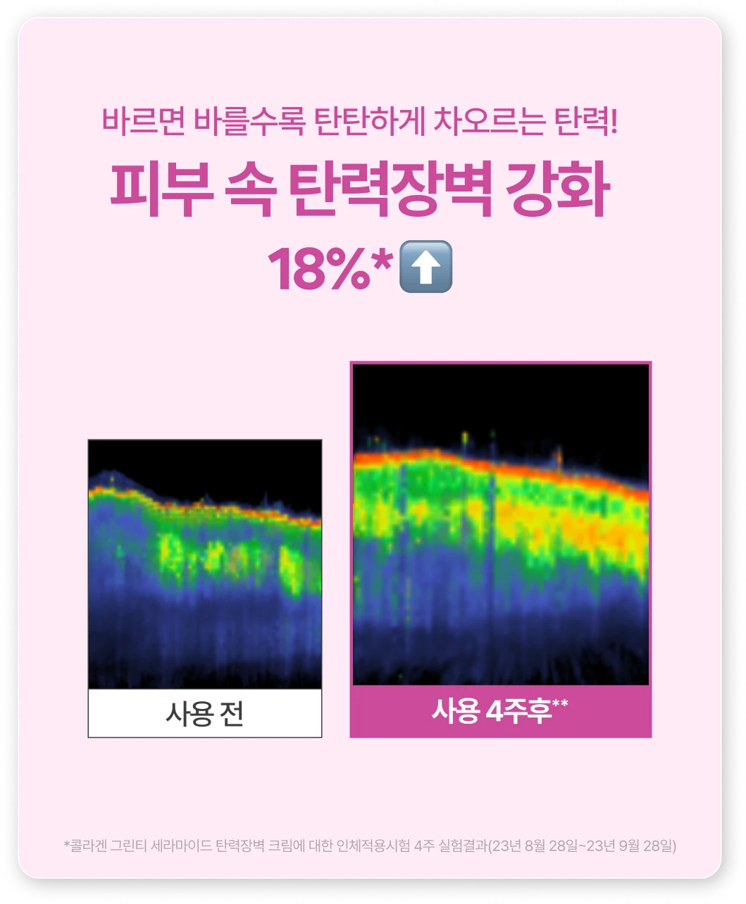 피부 속 탄력장벽 강화
