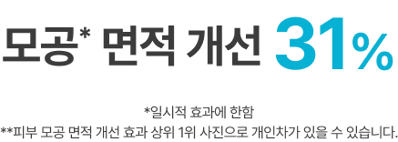 모공* 면적 개선 31% *일시적 효과에 한함 **피부 모공 면적 개선 효과 상위 1위 사진으로 개인차가 있을 수 있습니다. 