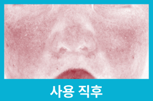 사용 직후