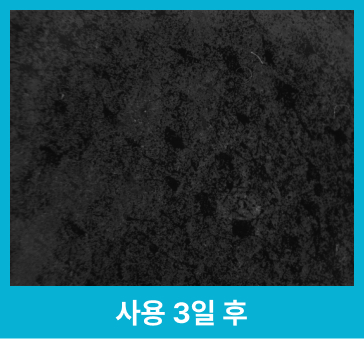 사용 3일 후 개선된 피부 확대 사진